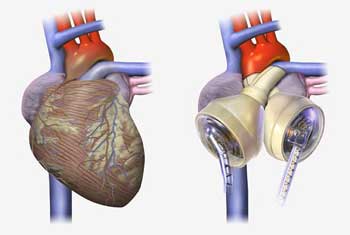 Implantation Science